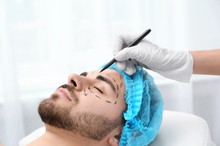 Plastic & Cosmetic Surgery NHS Hospitals, Dr. N. Naga Chaitanya