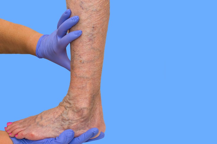 Vascular & Endovascular Surgery NHS Hospitals, Dr. N. Naga Chaitanya